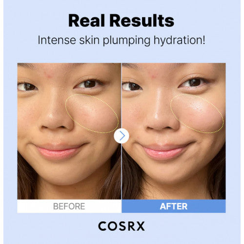 COSRX The Hyaluronic Acid 3 Serum drėkinamasis serumas