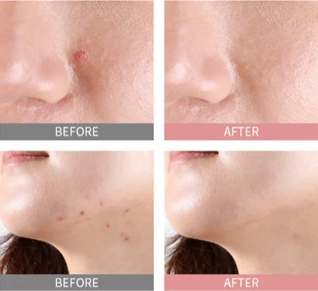 MIZON Good Bye Blemish Pink Spot taškinė priemonė nuo spuogų